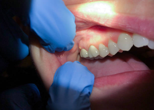 Best Emergency Cosmetic Dentistry (e.g., broken veneers) in Richmond, IL