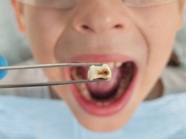 Best Weekend Emergency Dental Services in Richmond, IL